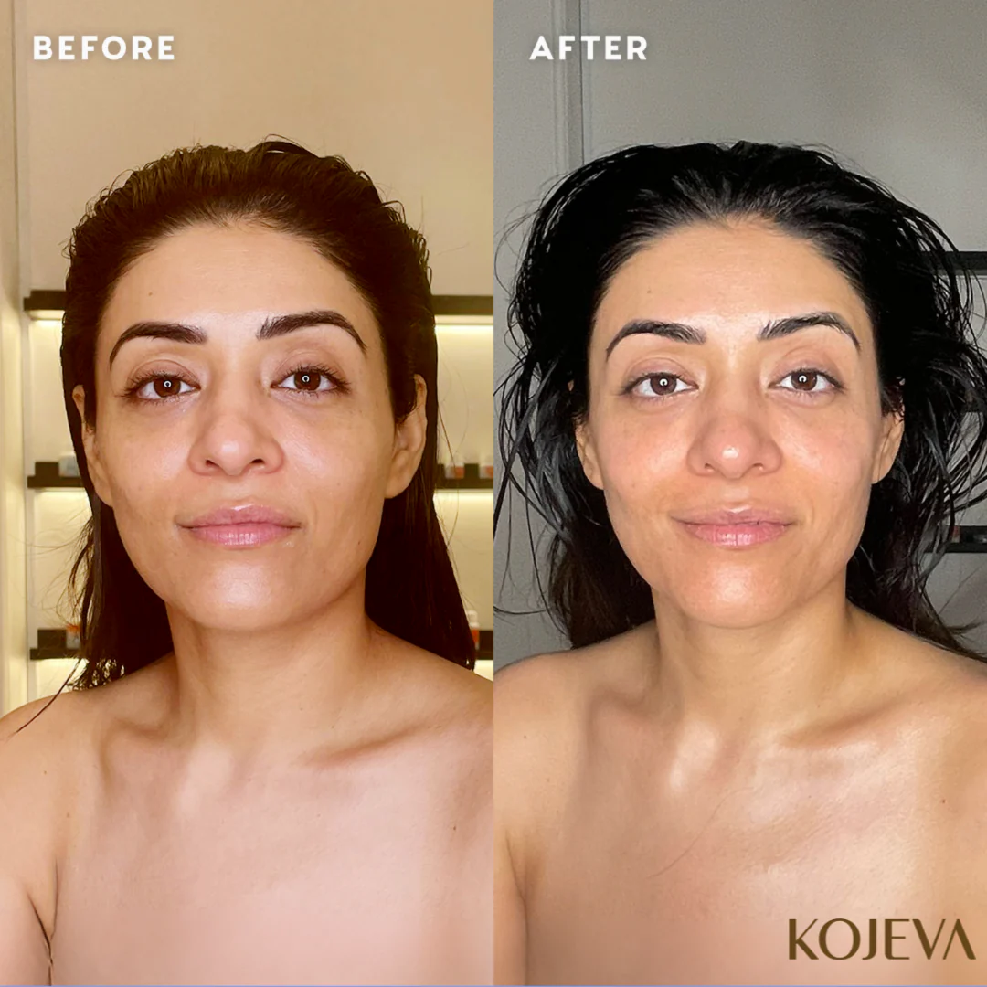 Kojeva Lymphatic Face Brush - Image 3